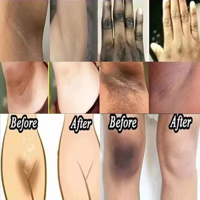 50ml Body Whitening Bleach Cream Brighten Underarm Elbow Knees Joint Removal Intimate Parts Dark Spots Melanin Snow Bleach Cream