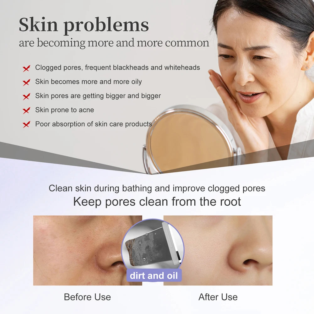 Ultrasonic Skin Scrubber – LED Pore Deep Cleansing IPX7
