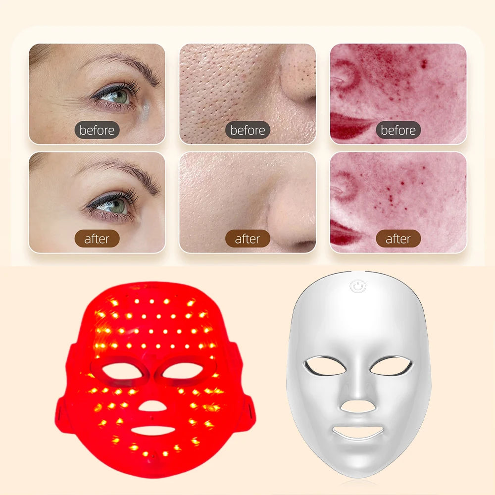 7-Color LED Photon Facial Mask – Rechargeable Skin Rejuvenation