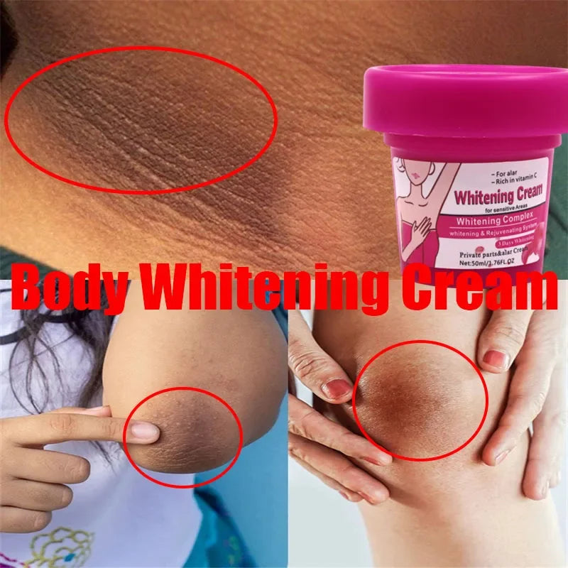 50ml Body Whitening Bleach Cream Brighten Underarm Elbow Knees Joint Removal Intimate Parts Dark Spots Melanin Snow Bleach Cream